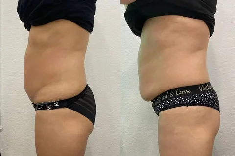 Курс процедур для похудения и коррекции фигуры - Доставка подарков в Екатеринбург