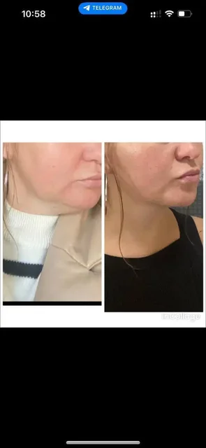 Аппаратная коррекция фигуры 25 процедур - Оформление праздников в Екатеринбург