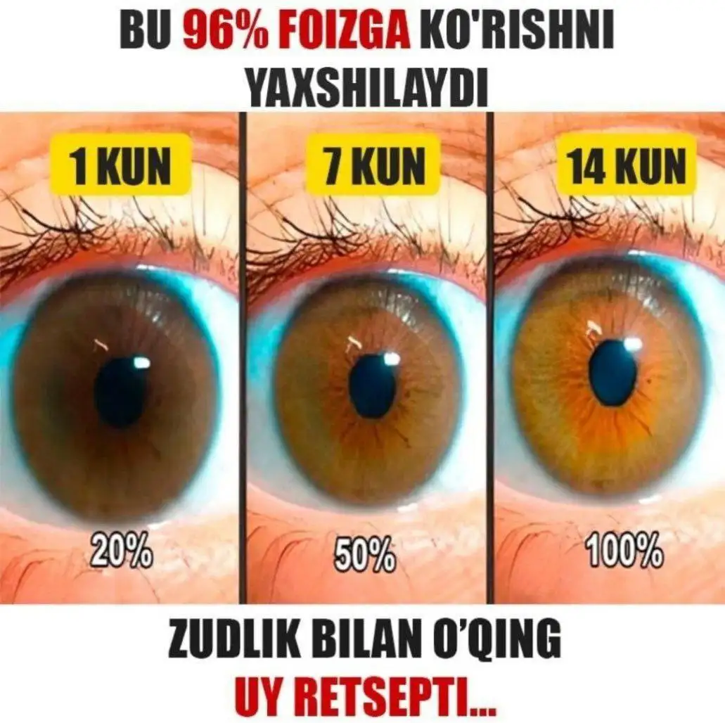 Восстановление зрения за 7 дней - Медицинские услуги (Услуги) в Уфа