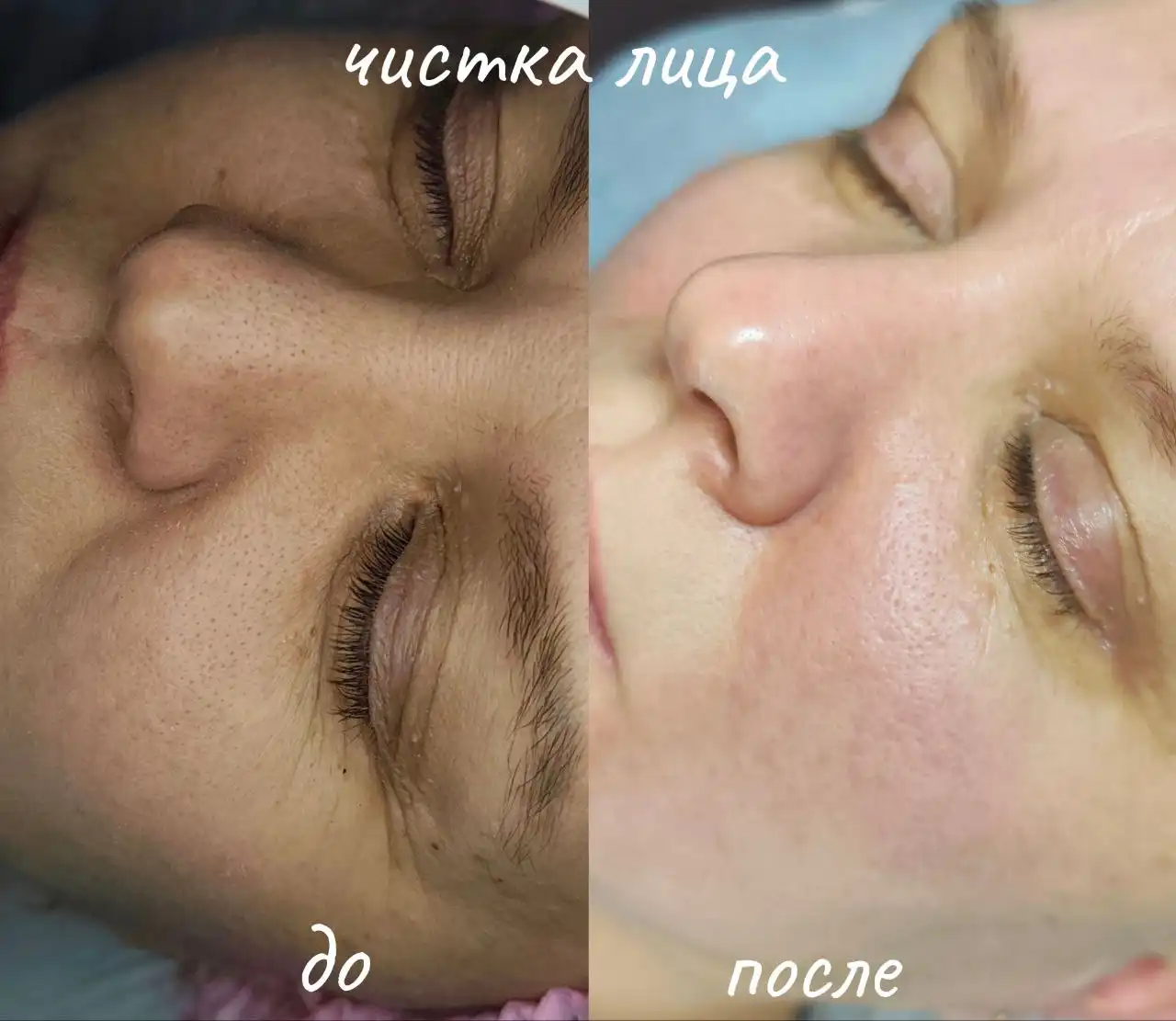 Услуги косметолога-эстетиста и массажиста в Красноярске