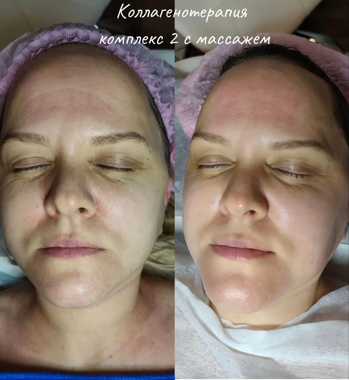 Услуги косметолога-эстетиста и массажиста в Красноярске