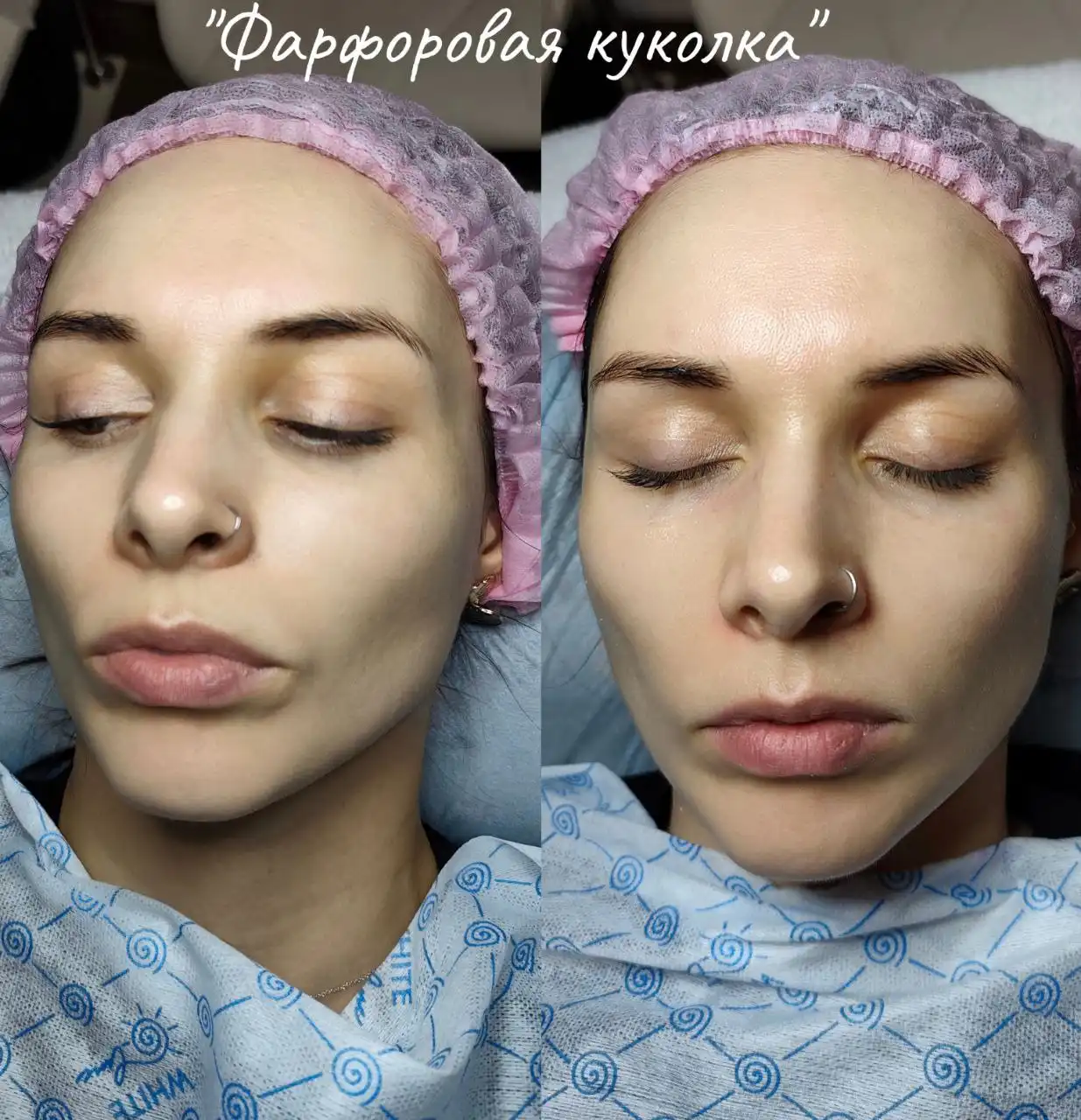 Услуги косметолога-эстетиста и массажиста в Красноярске