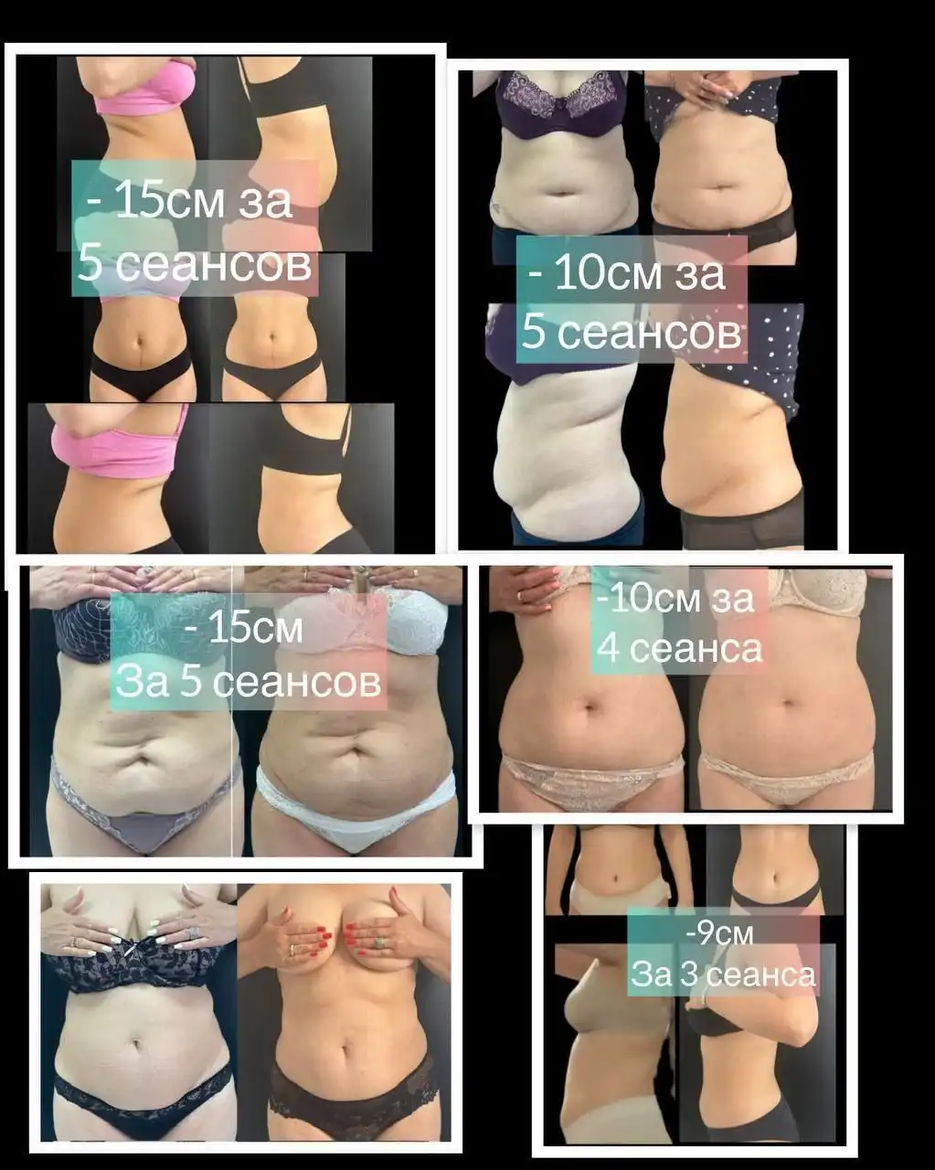 Услуги по похудению и реабилитации с тейпированием и кетгут терапией