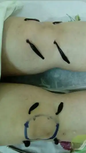 Гирудо-оздоровление пиявочками в Томске - Медицинские услуги (Услуги) в Томск