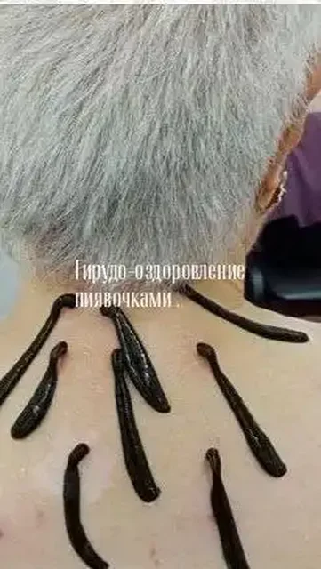 Гирудо-оздоровление пиявками - Услуги в Томск
