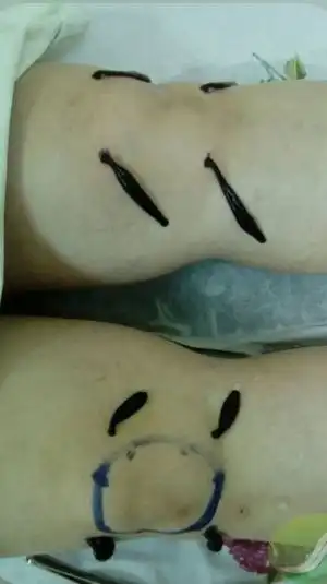 Гирудо-оздоровление пиявками - Медицинские услуги (Услуги) в Томск