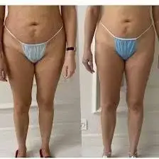 Вакуумно-роликовый массаж всего тела с подарками - Красота и уход в Томск