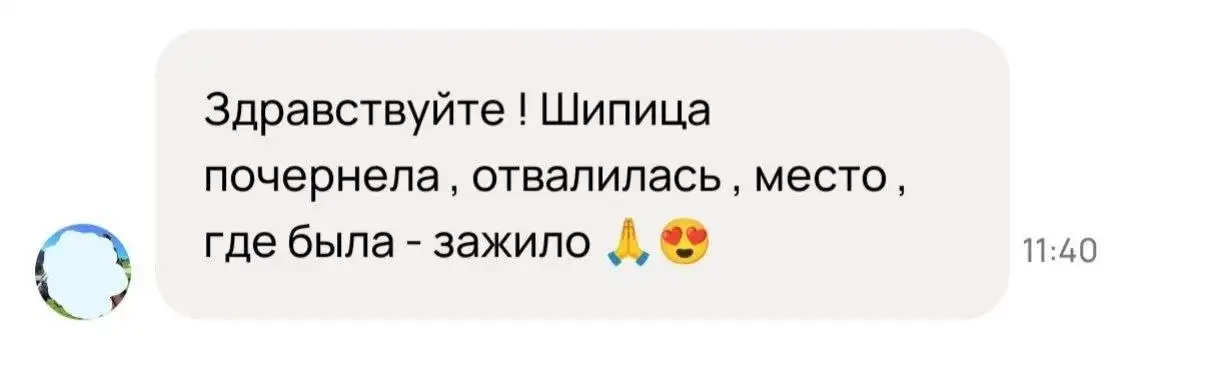 Чудо-мазь от наростов на стопах - Косметика (Красота и здоровье) в Барнаул