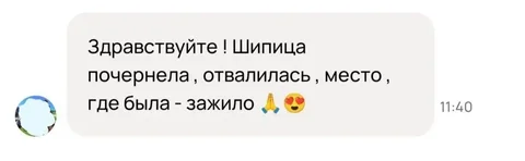 Чудо-мазь от наростов на стопах - Фены в Барнаул