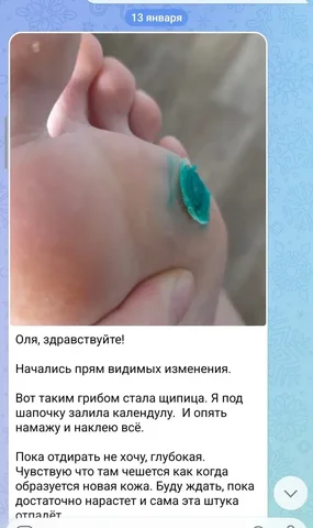 Натуральные кремы от кожных проблем и заговор ячменя - частное объявление в Барнаул