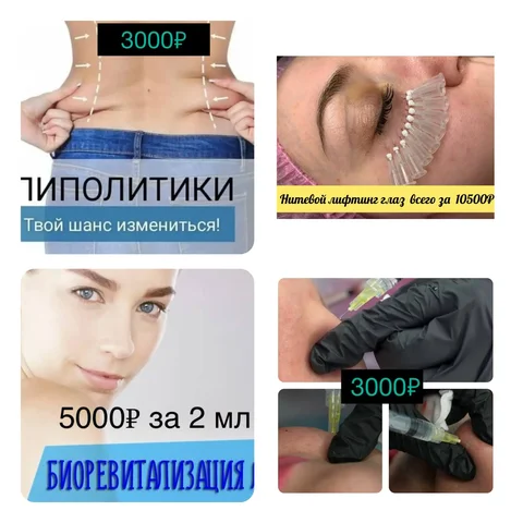 Услуги косметолога: липолитики, биоревитализация, нитевой лифтинг - Услуги в Сургут