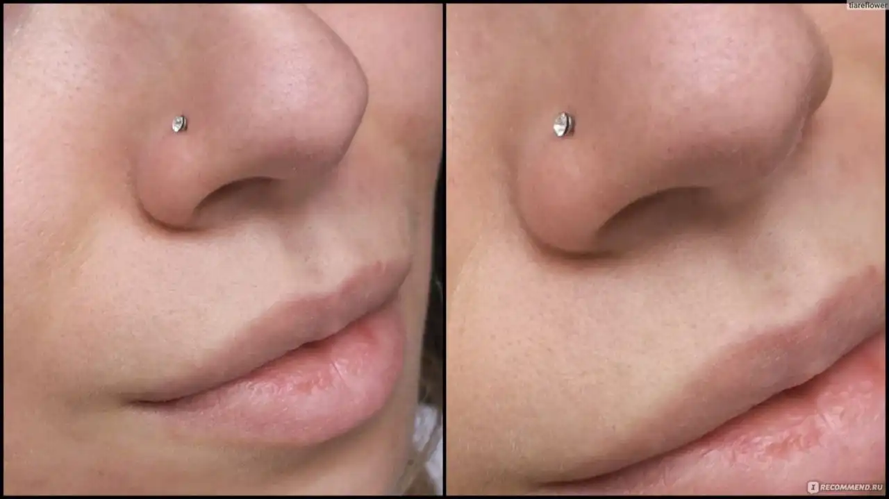 Услуги прокола ушей и пирсинга носа
