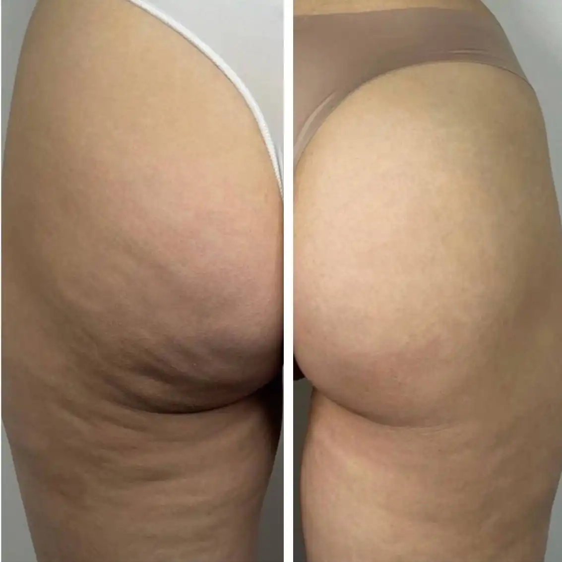 Экспресс моделирование: турбомассажи тела с обертываниями