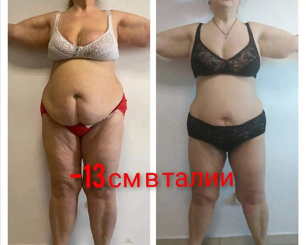 10 турбомассажей тела с подарками - Массаж (Услуги) в Сургут