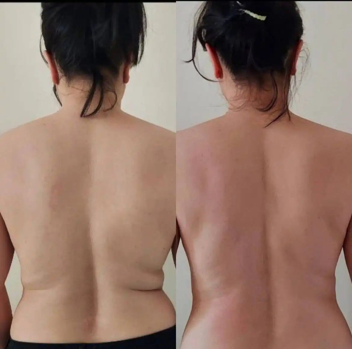 10 турбомассажей тела с подарками - Массаж (Услуги) в Сургут