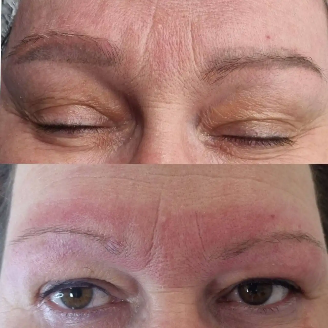 Удаление татуировок и перманента в Сургуте - Красота и здоровье (Услуги) в Сургут