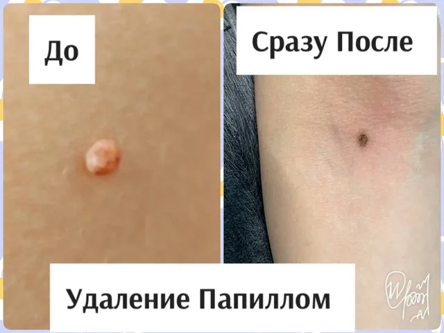 Услуги косметологии и дерматологии в Сургуте - Реклама в Сургут