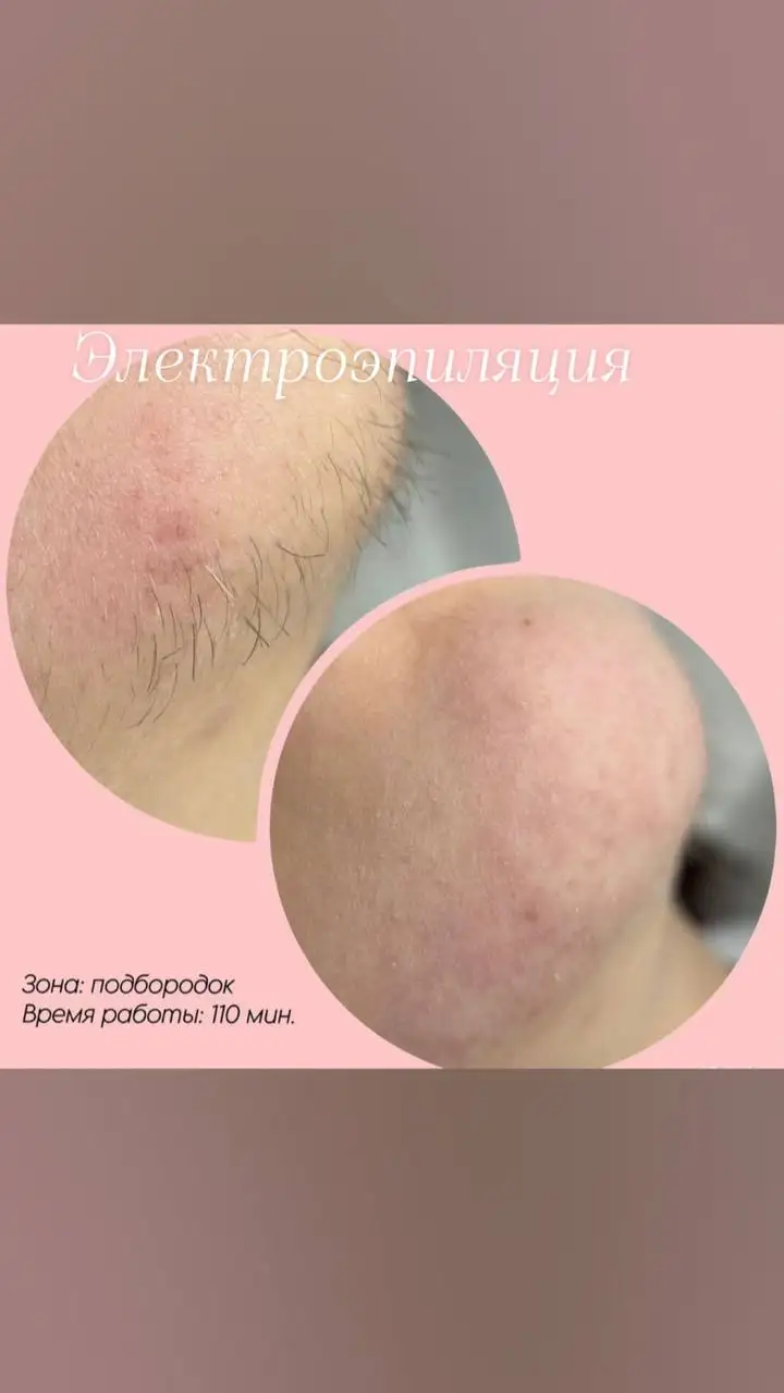 Услуги косметологии и дерматологии в Сургуте - Косметология (Услуги) в Сургут