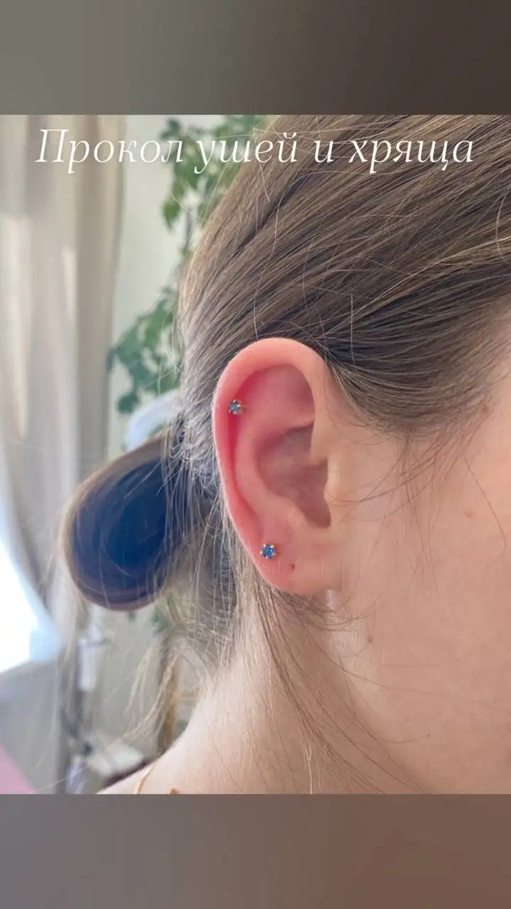 Услуги косметологии и дерматологии в Сургуте - Косметология (Услуги) в Сургут