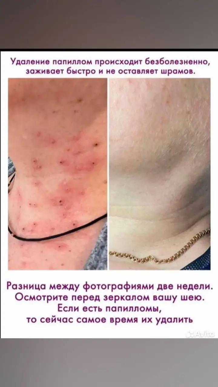 Услуги косметологии и дерматологии в Сургуте - Косметология (Услуги) в Сургут