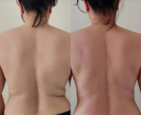 LPG-массаж с новой 3D манипулой - частное объявление в Сургут