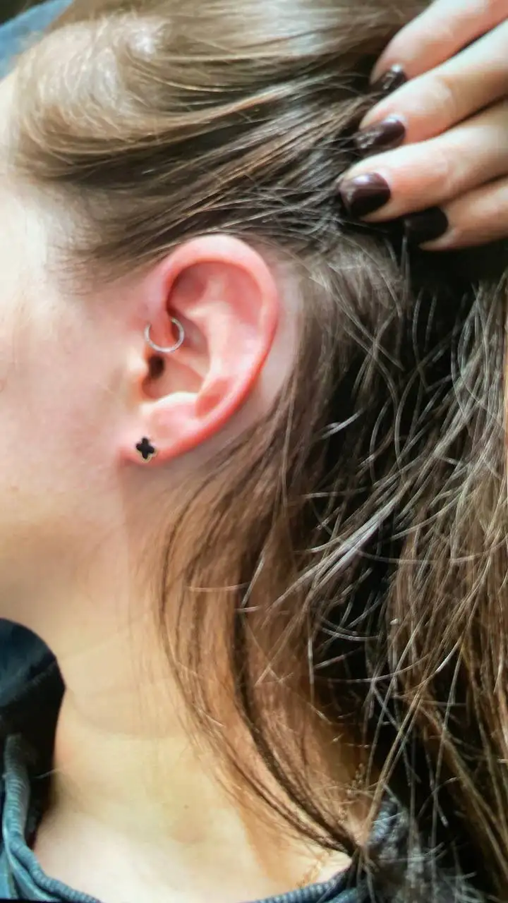 Услуги косметологии и дерматологии в Сургуте - Косметология (Красота и здоровье) в Сургут