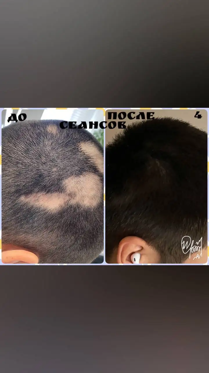 Услуги косметологии и дерматологии в Сургуте - Косметология (Красота и здоровье) в Сургут