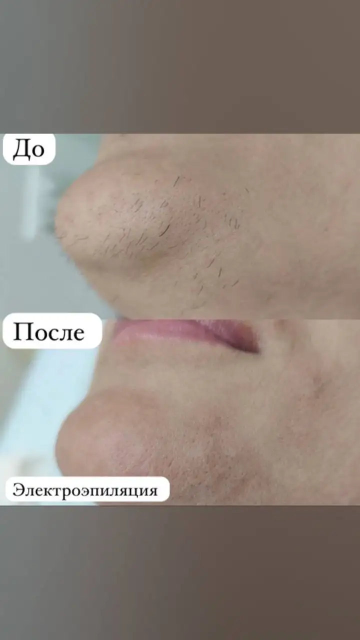 Услуги косметологии и дерматологии в Сургуте - Косметология (Красота и здоровье) в Сургут