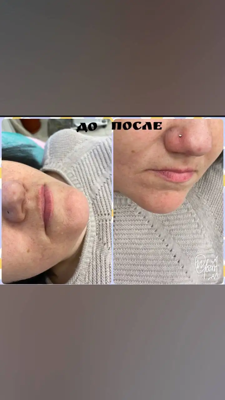 Услуги косметологии и дерматологии в Сургуте - Косметология (Красота и здоровье) в Сургут