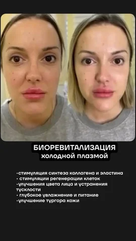 Топ-5 косметологических процедур для сияющей кожи - Интернет-услуги в Сургут