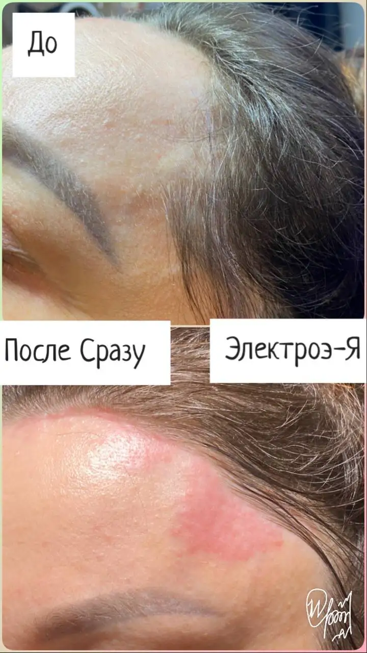 Косметологические услуги: прокол ушей, пирсинг, электроэпиляция, чистка лица, лечение заболеваний - Косметологические услуги (Красота и здоровье) в Сургут