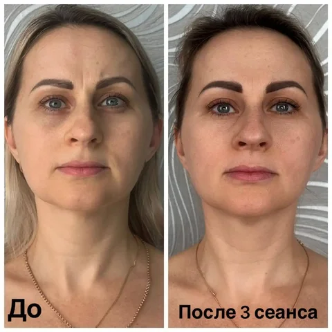 Сеансы витапластики - Красота и здоровье в Краснодар