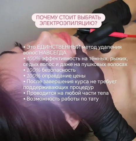 Услуги мастера электроэпиляции в Краснодаре - Работа в Краснодар