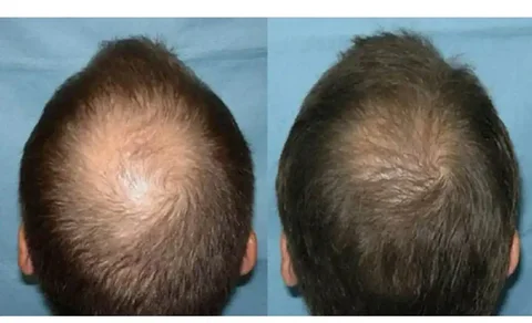 Шикарная шевелюра доступно - частное объявление в Краснодар