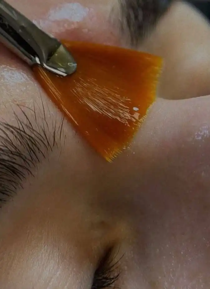 Желтый пилинг для сияющей кожи - Косметологические услуги (Красота и здоровье) в Краснодар