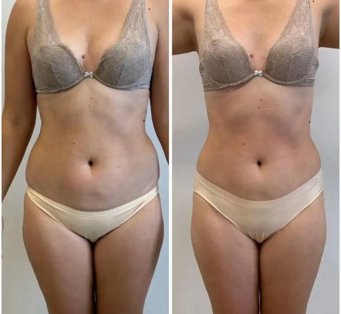 Ищу моделей на ручной корректирующий массаж - Массаж (Услуги) в Краснодар