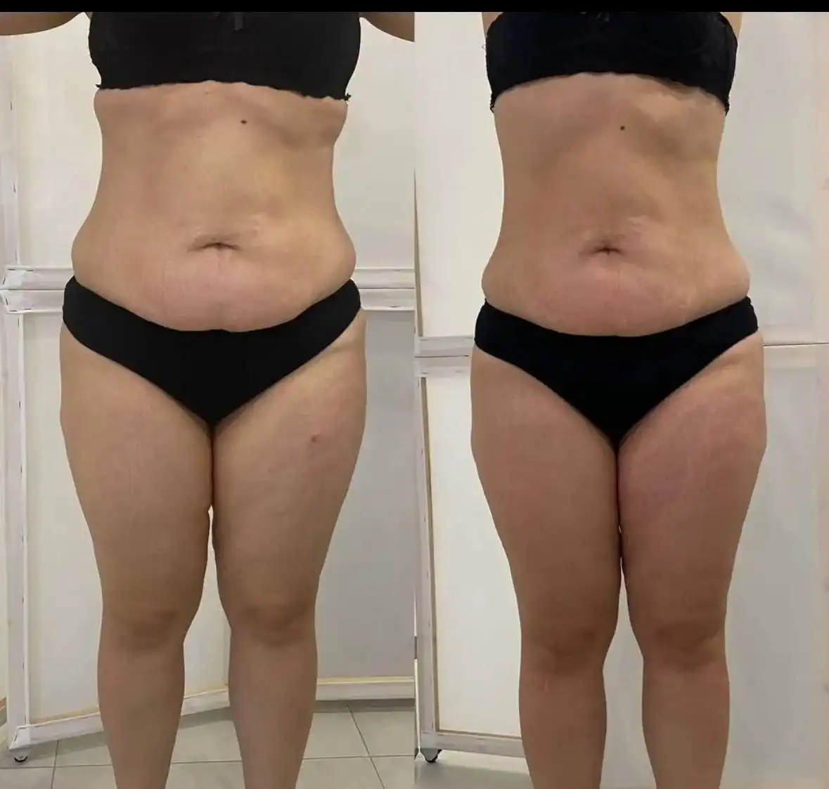 Ищу моделей на ручной корректирующий массаж - Массаж (Услуги) в Краснодар