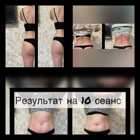 Коррекция фигуры массажем к 8 марта - Консультации в Краснодар