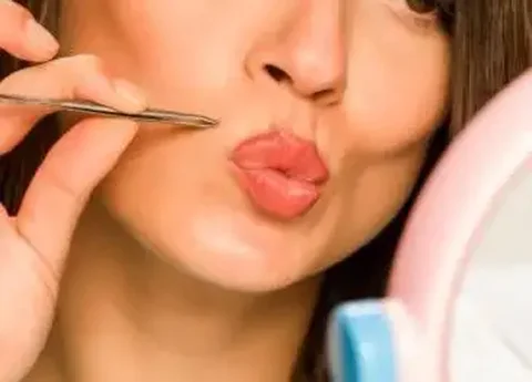 Электроэпиляция в Краснодаре - Услуги в Краснодар