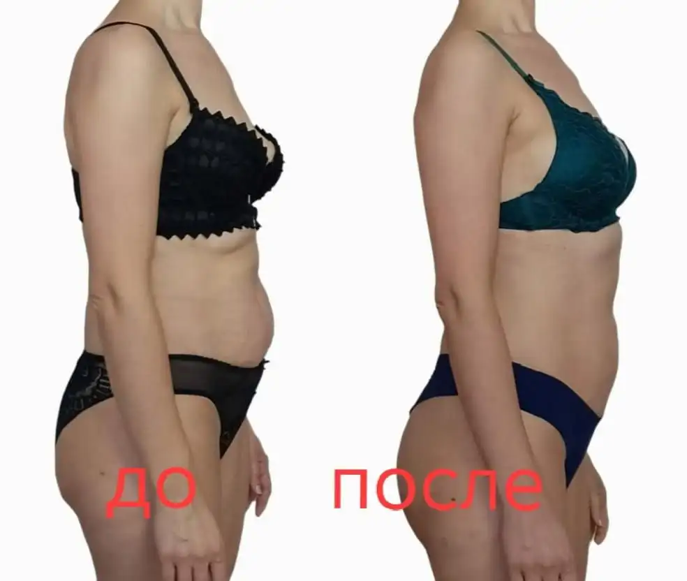 Уникальный массаж "Три в одном" для живота и осанки в Краснодаре - Массаж (Услуги) в Краснодар