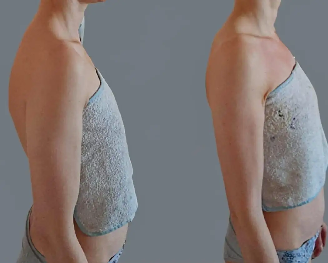 Важность правильной осанки и миофасциальный массаж - Массаж (Услуги) в Краснодар