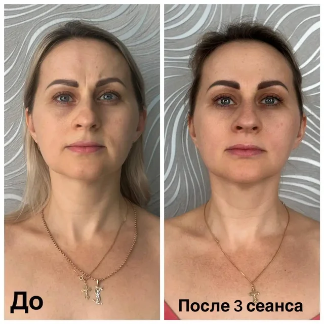 Сеансы витапластики в Краснодаре - Работа в Краснодар