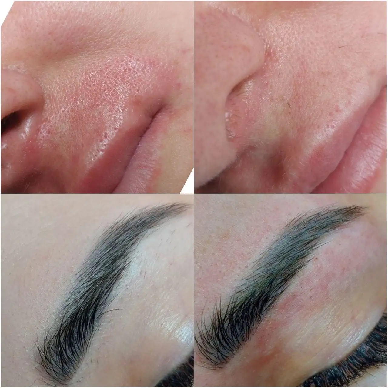 Кабинет эстетической электроэпиляции - Косметология (Услуги) в Краснодар