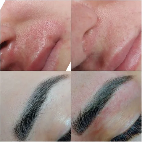 Кабинет эстетической электроэпиляции - Сварочные работы в Краснодар