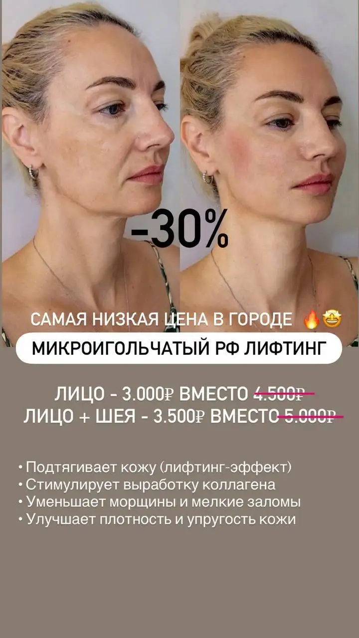 Услуги врача-косметолога со скидками - Косметология (Красота и здоровье) в Краснодар