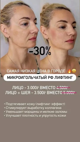 Услуги врача-косметолога со скидками - частное объявление в Краснодар