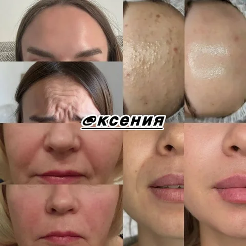 Услуги косметолога с медицинским образованием - Косметология в Краснодар