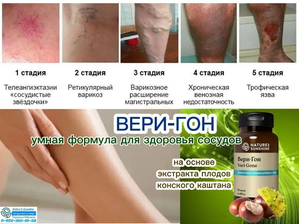Вери Гон NSP для сосудов - Услуги в Неизвестно
