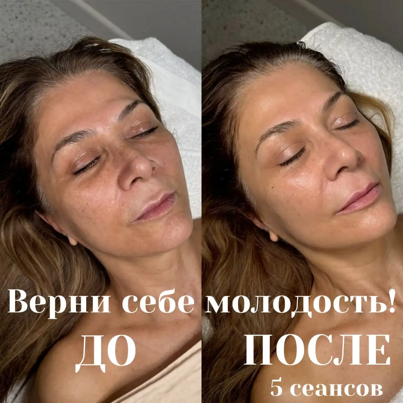 Аппаратный массаж лица - 3 услуги в 1 сеансе - Красота и здоровье (Услуги) в Иркутск