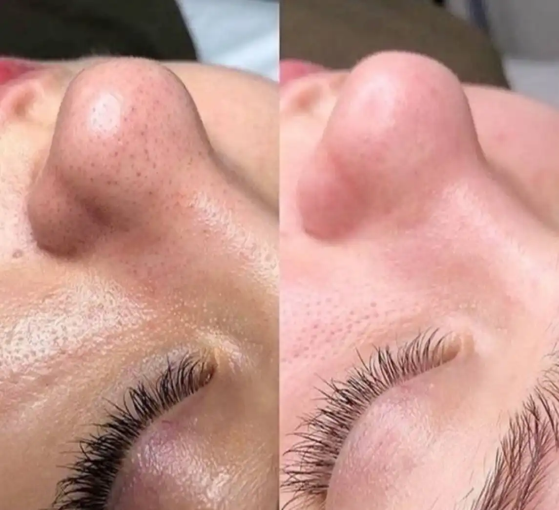 Профессиональные косметологические услуги в Новосибирске